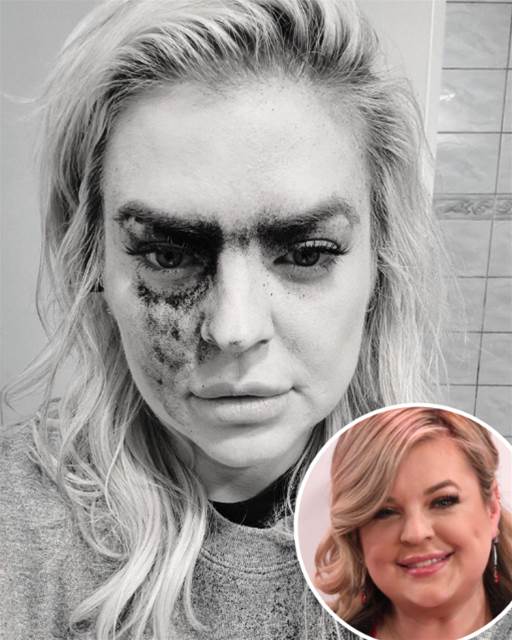 Shocking Health Update Kirsten Storms’ GH Future in Doubt After